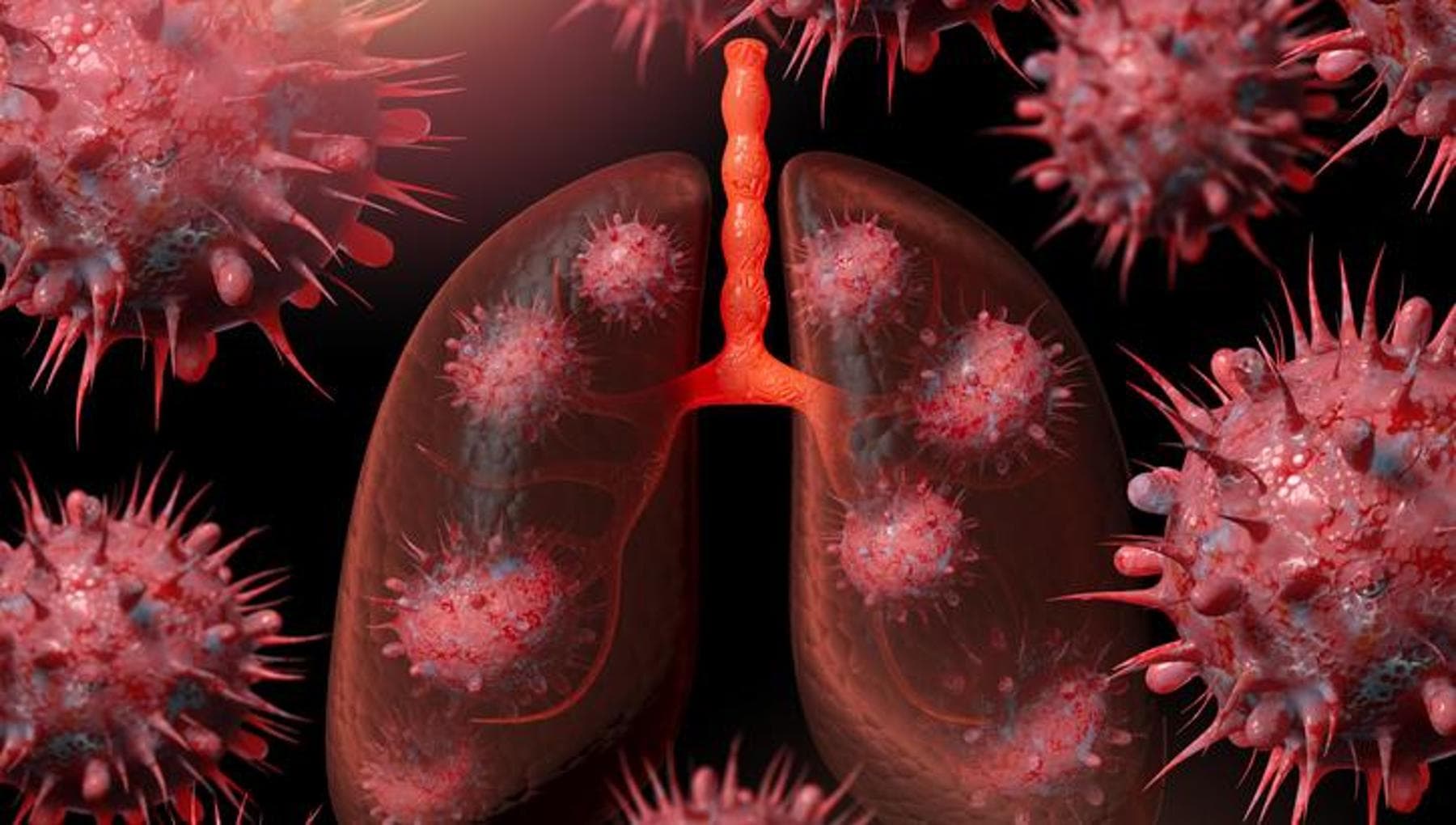 Cancer du poumon, un vaccin expérimental augmente la survie jusqu'à 47 %