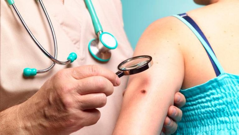 Le mélanome, le premier vaccin personnalisé à ARNm, réduit de 42 % le risque de récidive de la tumeur.


