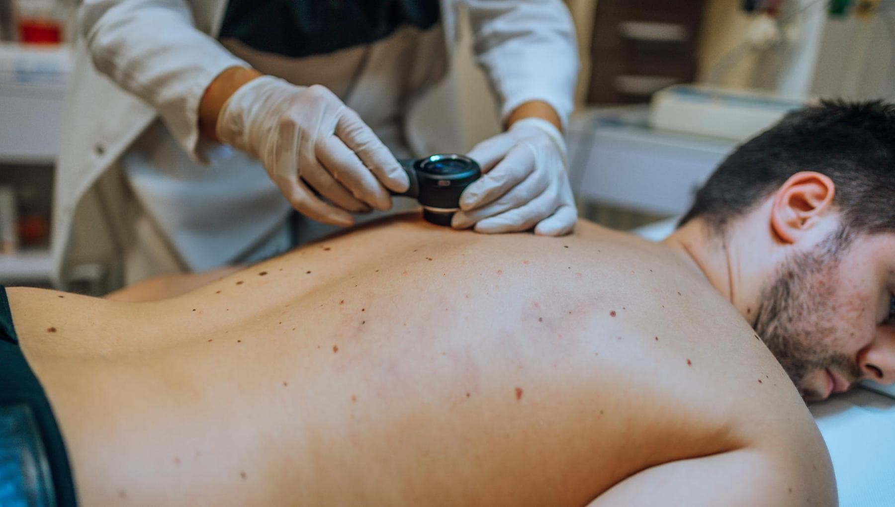 Mélanome : les enjeux de la prévention et les nouveaux besoins des patients